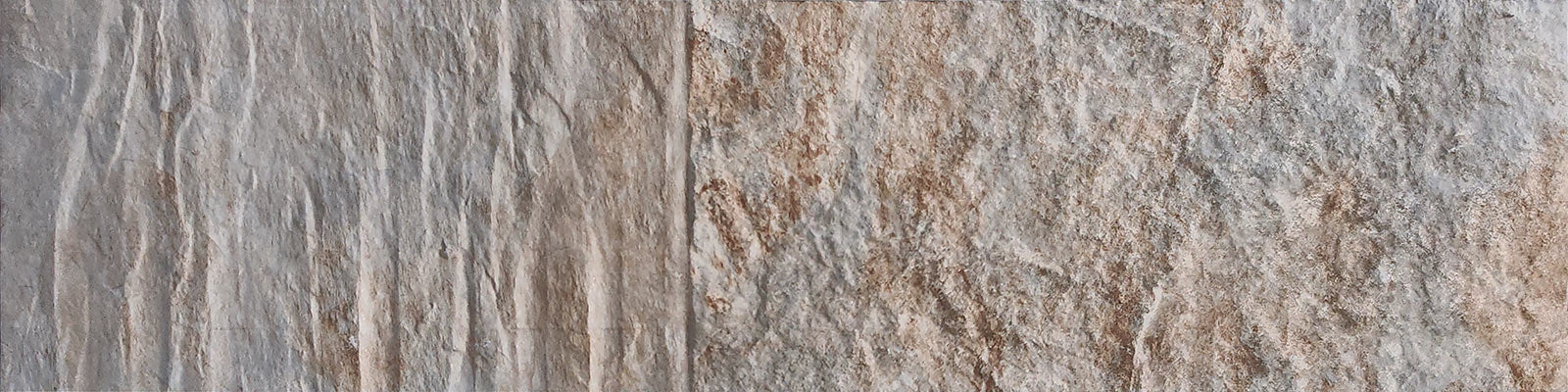 Fractures